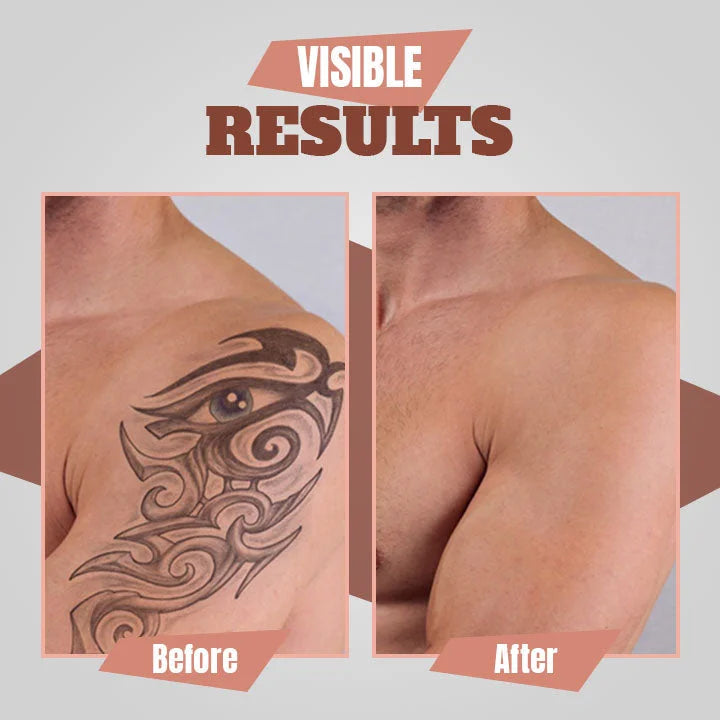 7 days Tattoo Removal Cream