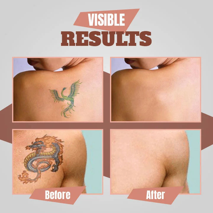 7 days Tattoo Removal Cream